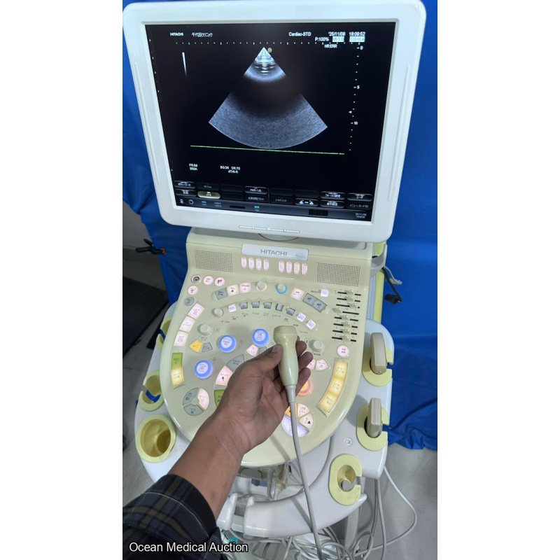 Hitachi avius ultrasound with convex,linear and cardiac probe
