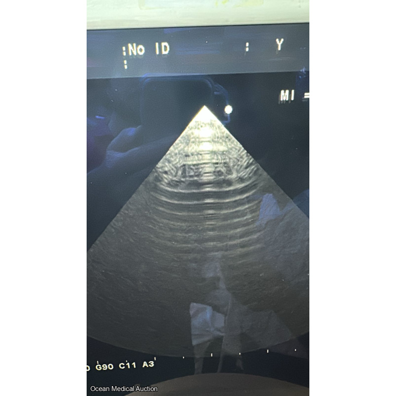 Aloka ust 52114P ntraoperative / phased-array ultrasound transducer (probe) SN.200D3785