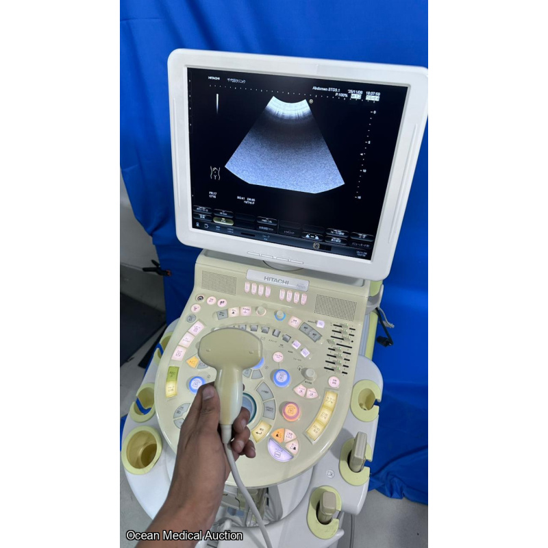 Hitachi avius ultrasound with convex,linear and cardiac probe