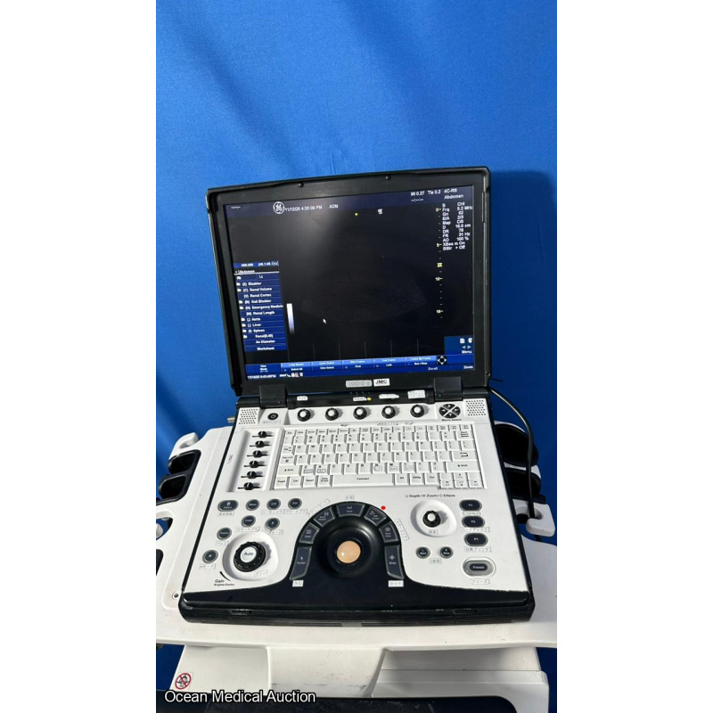 GE Logiq E Portable Ultrasound System (2012) with 3S-RS Cardiac Prob