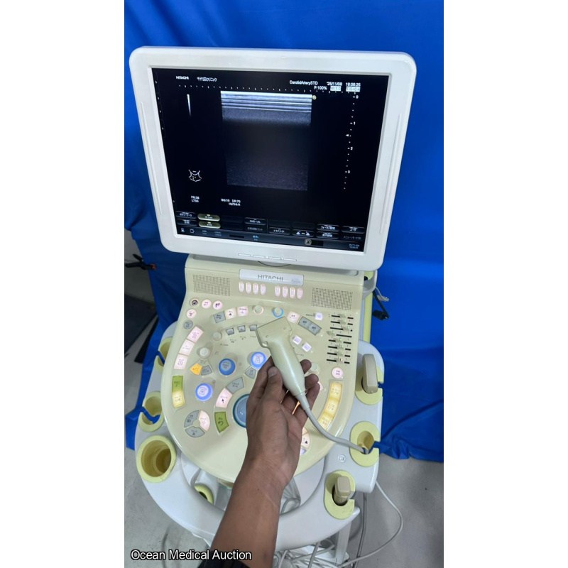 Hitachi avius ultrasound with convex,linear and cardiac probe