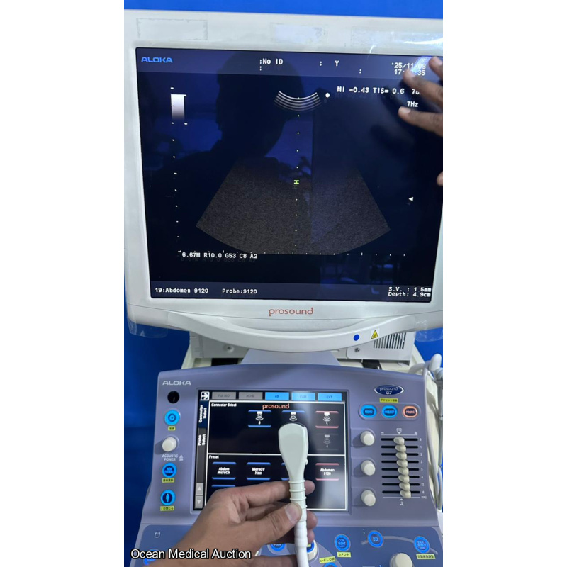 Hitachi Aloka alpha 7 ultrasound with convex,linear and cardiac probe