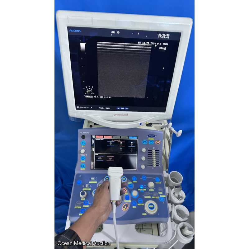 Hitachi Aloka alpha 7 ultrasound with convex,linear and cardiac probe
