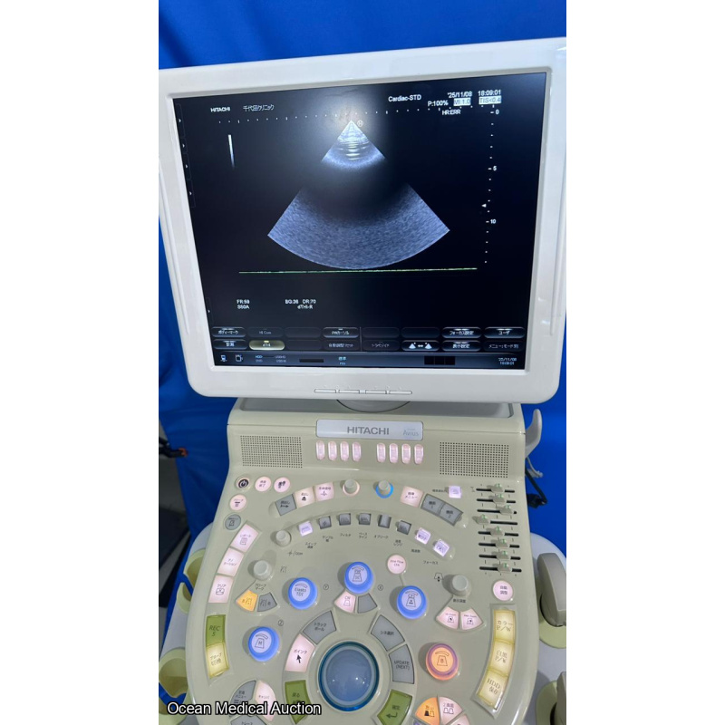 Hitachi avius ultrasound with convex,linear and cardiac probe