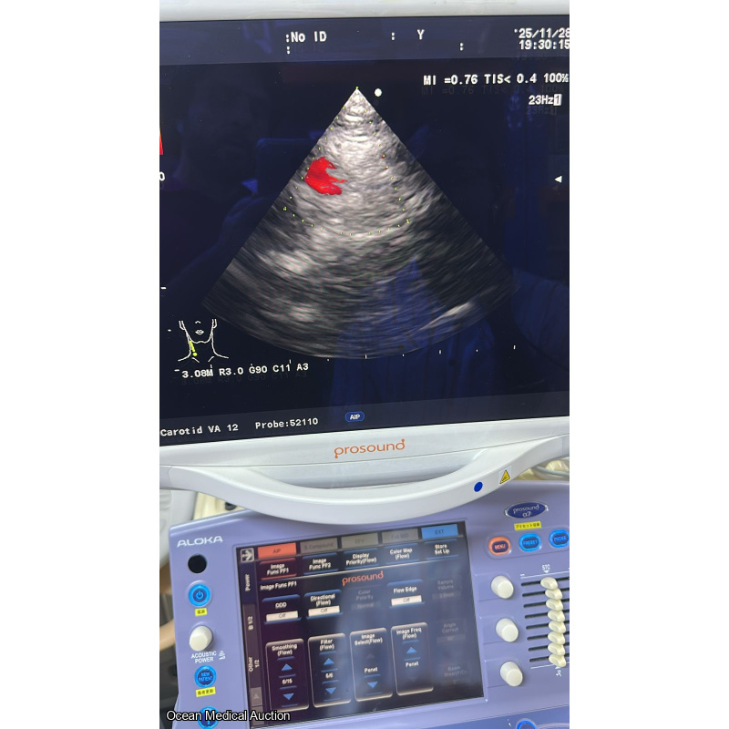 Aloka ust 52110s neonatal / pediatric T.E.E. SN.20004764