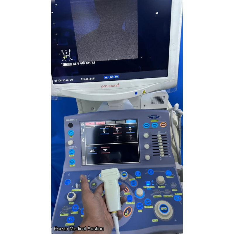 Hitachi Aloka alpha 7 ultrasound with convex,linear and cardiac probe