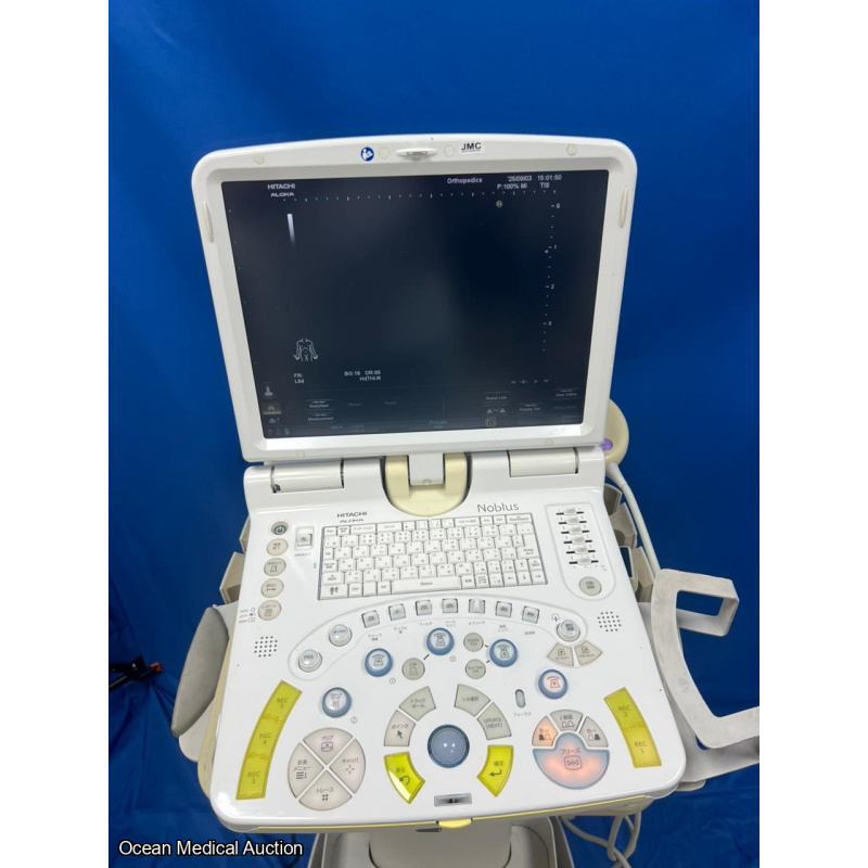 Hitachi Aloka Nobulus Ultrasound System + Linear Transducer (MAF:2013)