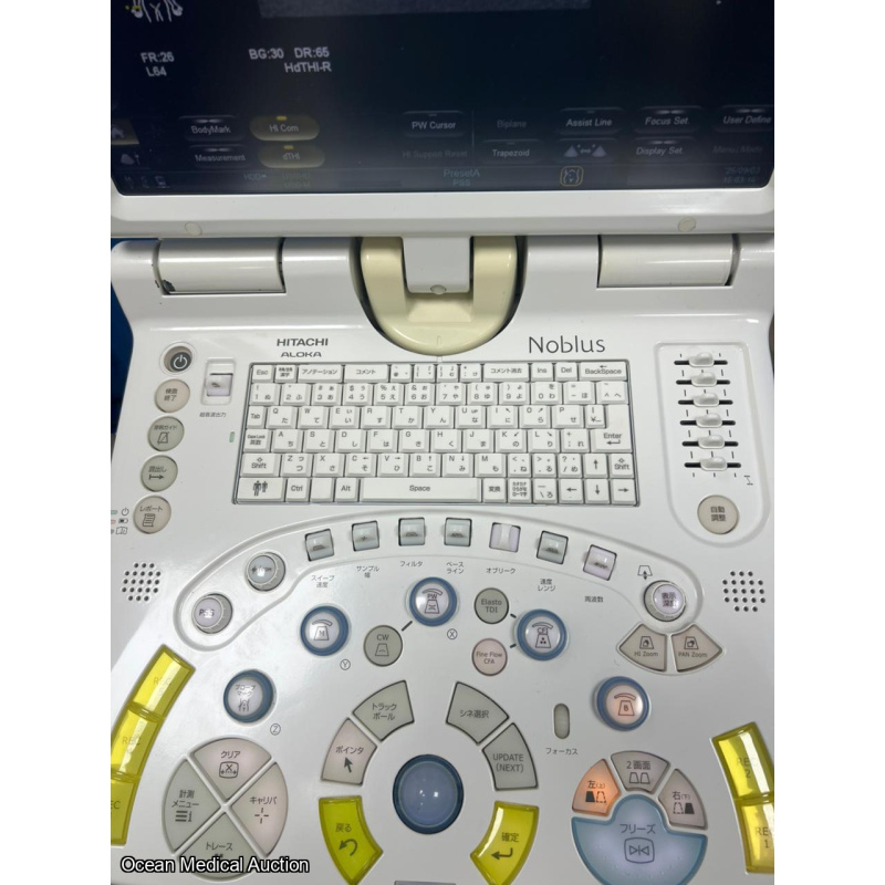 Hitachi Aloka Nobulus Ultrasound System + Linear Transducer (MAF:2013)