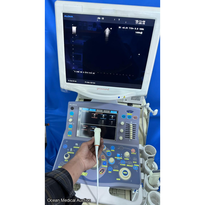 Hitachi Aloka alpha 7 ultrasound with convex,linear and cardiac probe