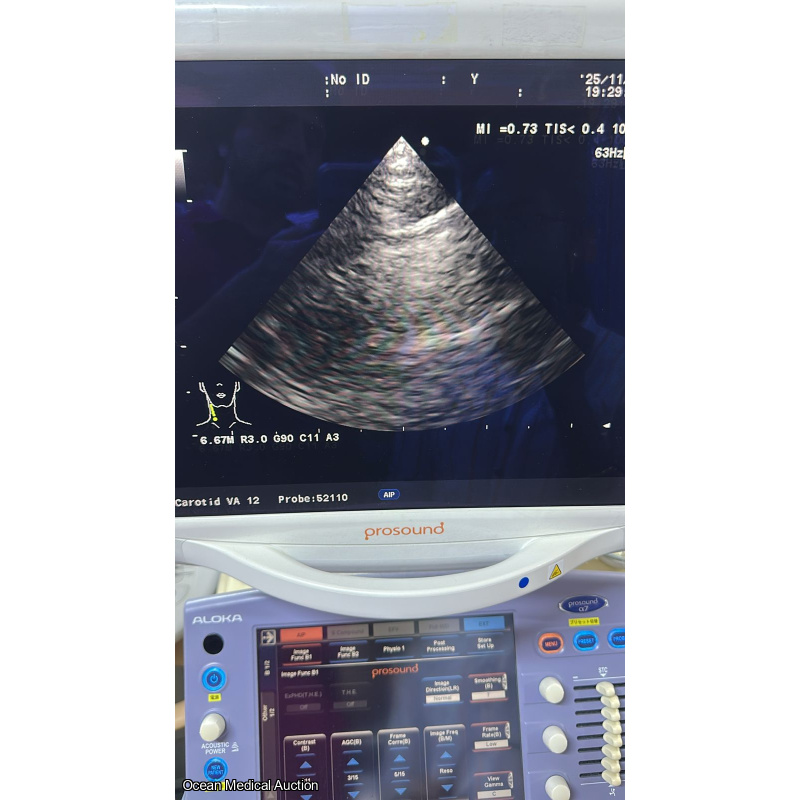Aloka ust 52110s neonatal / pediatric T.E.E. SN.20004764